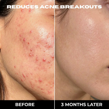 The 3 STEP Clear Skin Set