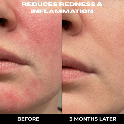 The 3 STEP Clear Skin Set